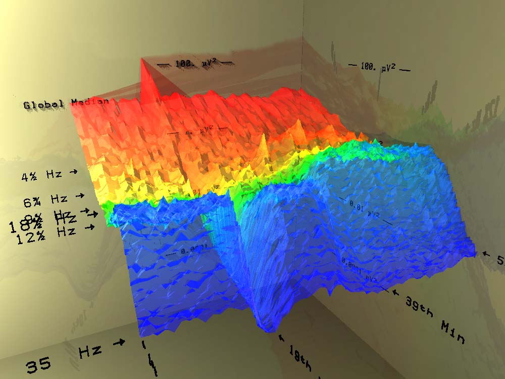 3D plot of surgery report